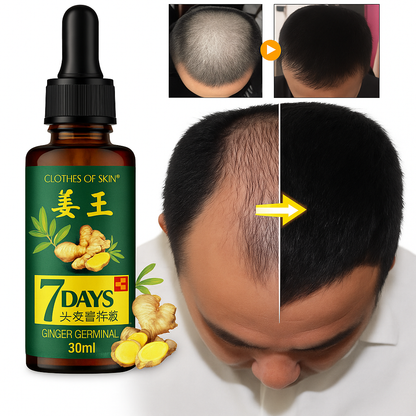 7 Days Ginger Hair Serum – 30ml | Rapid Natural Growth