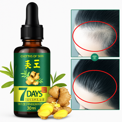 7 Days Ginger Hair Serum – 30ml | Rapid Natural Growth