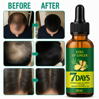 7 Days Ginger Hair Serum – 30ml | Rapid Natural Growth